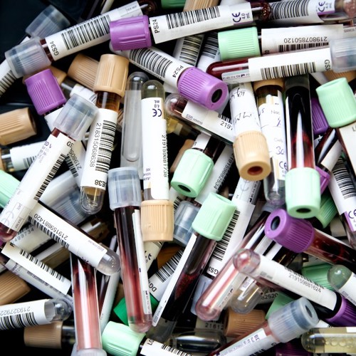 Image L’APTS préoccupée par les retards d’analyses au CUSM - APTS Image L’APTS préoccupée par les retards d’analyses au CUSM - APTS