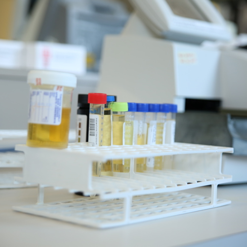 Abolition of the graduate medical laboratory technician job title | Unions reject a phony solution to the labour shortage - APTS Abolition of the graduate medical laboratory technician job title | Unions reject a phony solution to the labour shortage - APTS